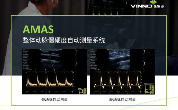 飞依诺AMAS系统