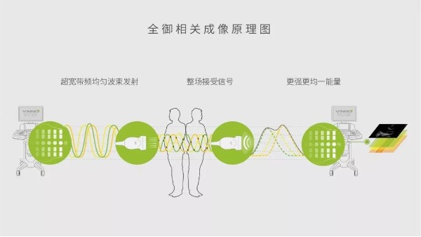 飞依诺超声全御相关成像——开启超声图像的新视界