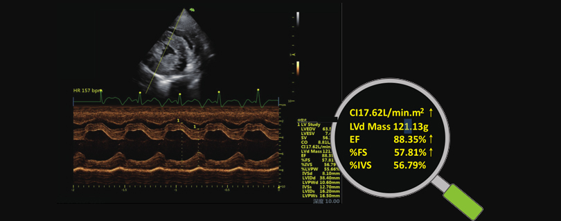 VCQ心脏功能自动评判功能包