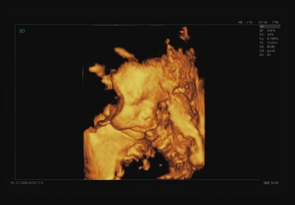30周胎儿3D图