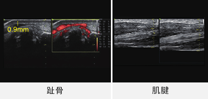 肌骨医疗