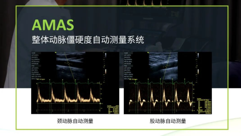 飞依诺AMAS系统