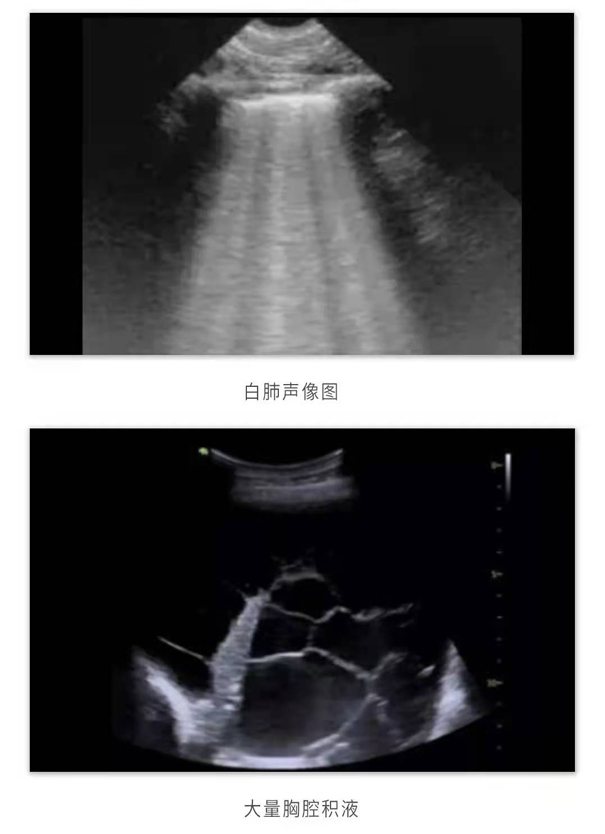 飞依诺便携超声扫查图像