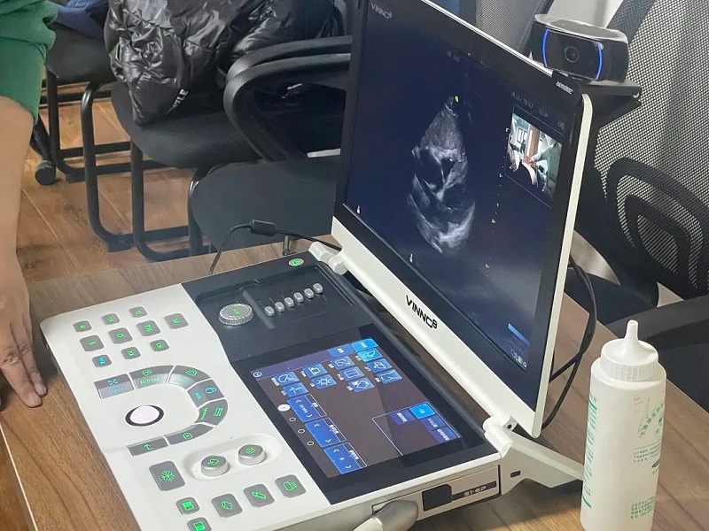 飞依诺超声