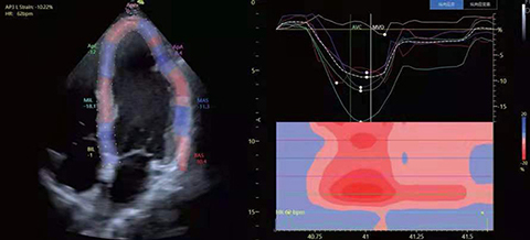 心脏辅助诊断