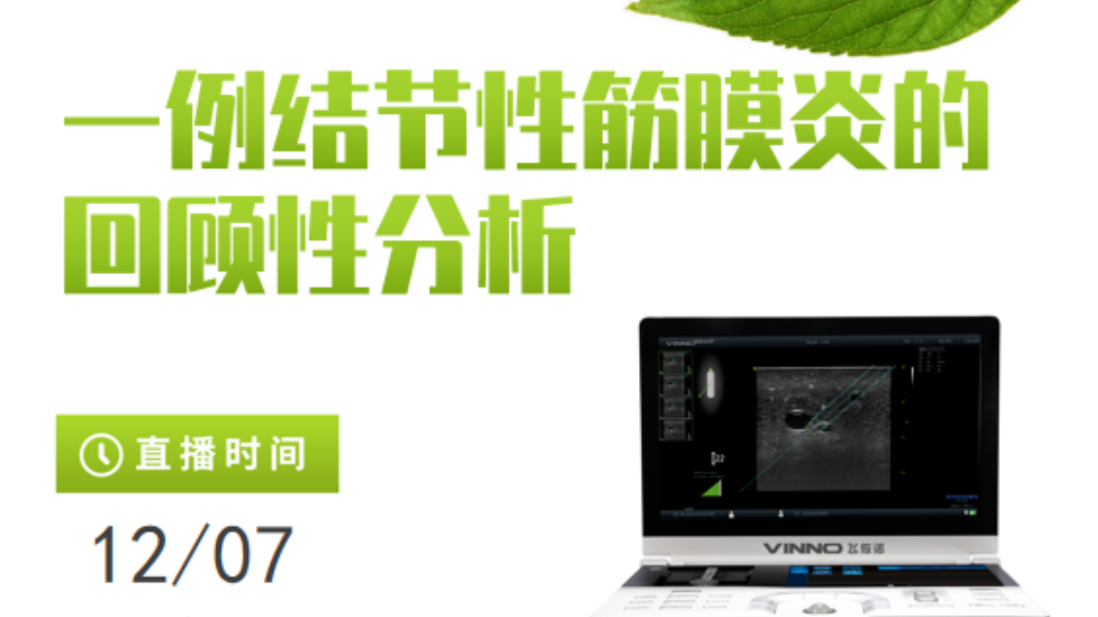 专家讲堂预告 | 一例结节性筋膜炎的回顾性分析