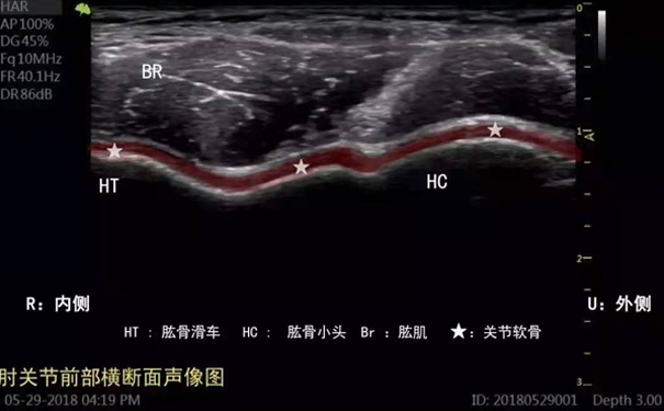 肘关节标准切面