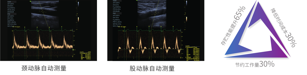 心血管检查——整体动脉僵硬度自动测量系统(AMAS)