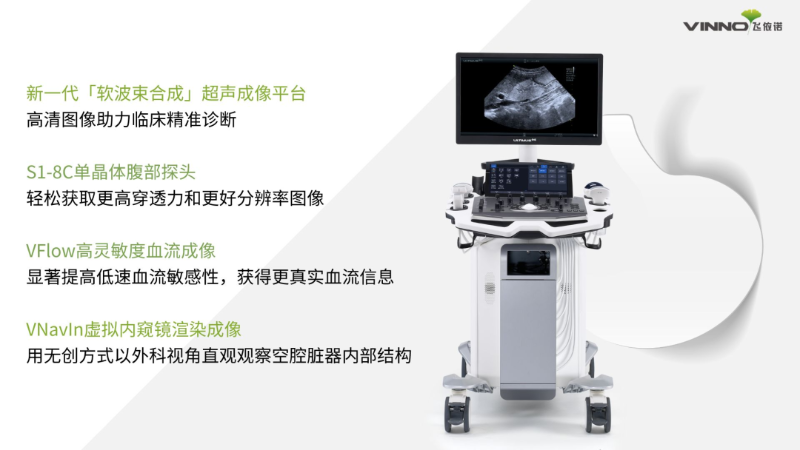 飞依诺 ULTIMUS 9E