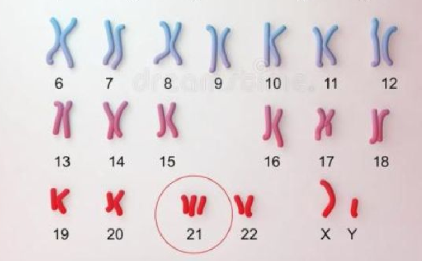 “21号”染色体