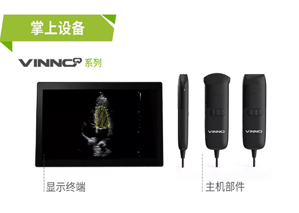 掌上超声