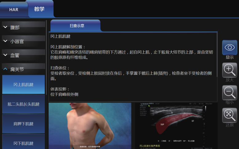 超声教学