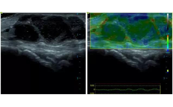 肌骨超声图像