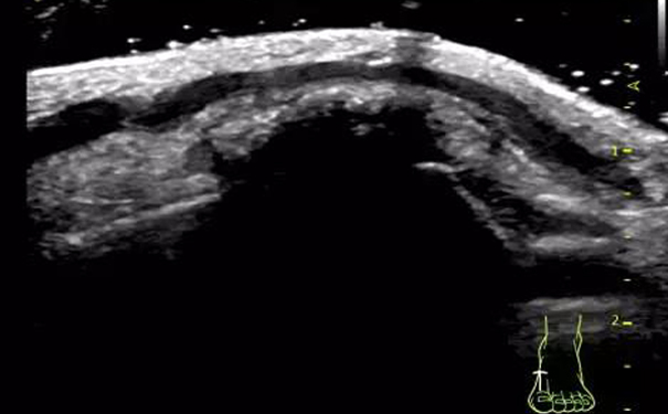 肌骨超声图像