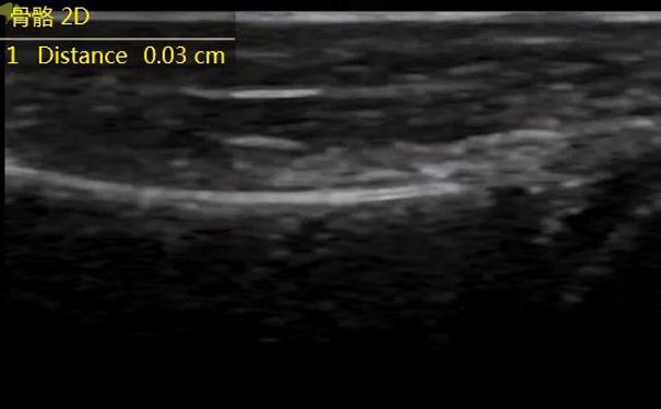肌骨超声图像