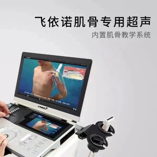 肌骨专用超声