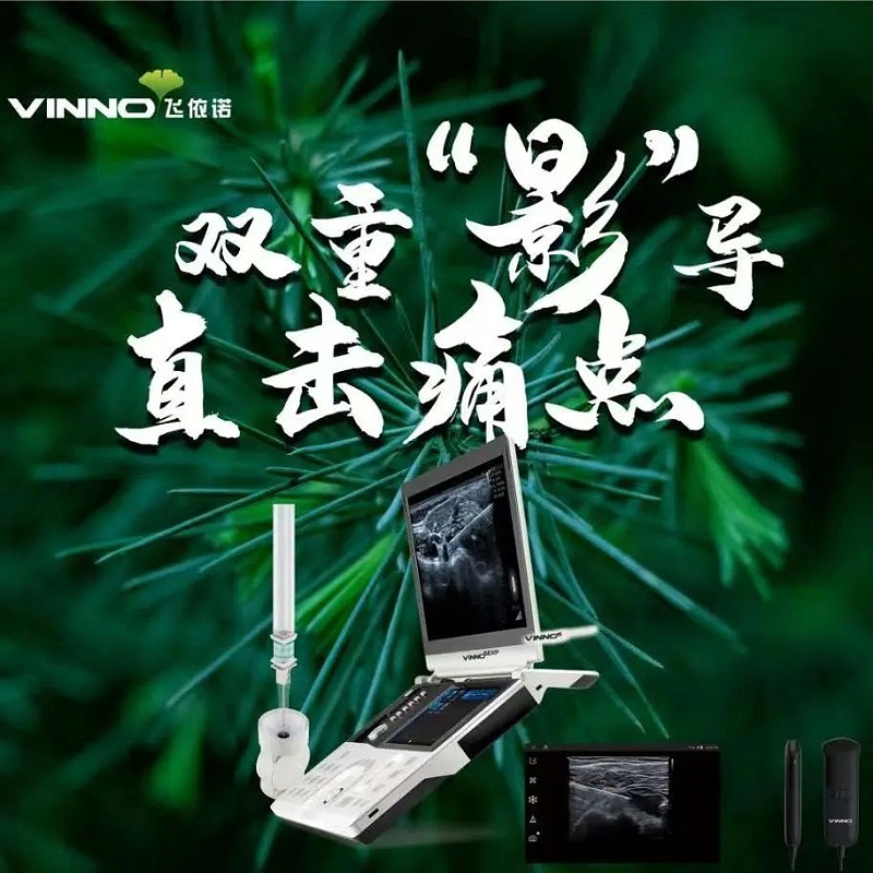 麻醉疼痛超声