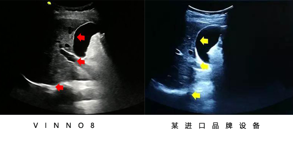 飞依诺彩超设备与其他设备图像对比