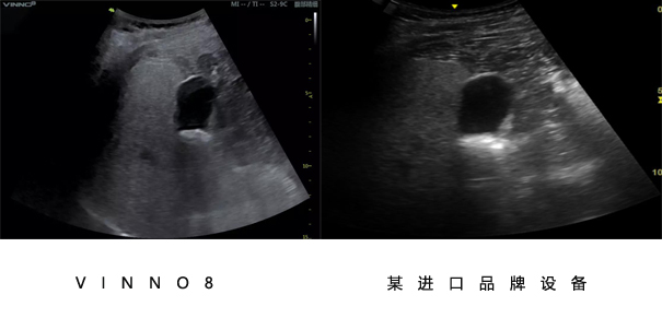 飞依诺彩超设备与其他品牌设备对比