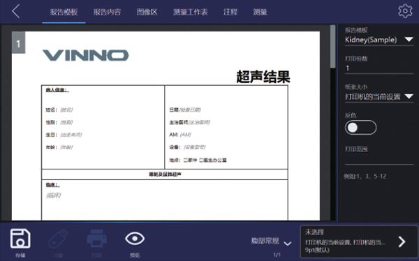 VReport 自动传输