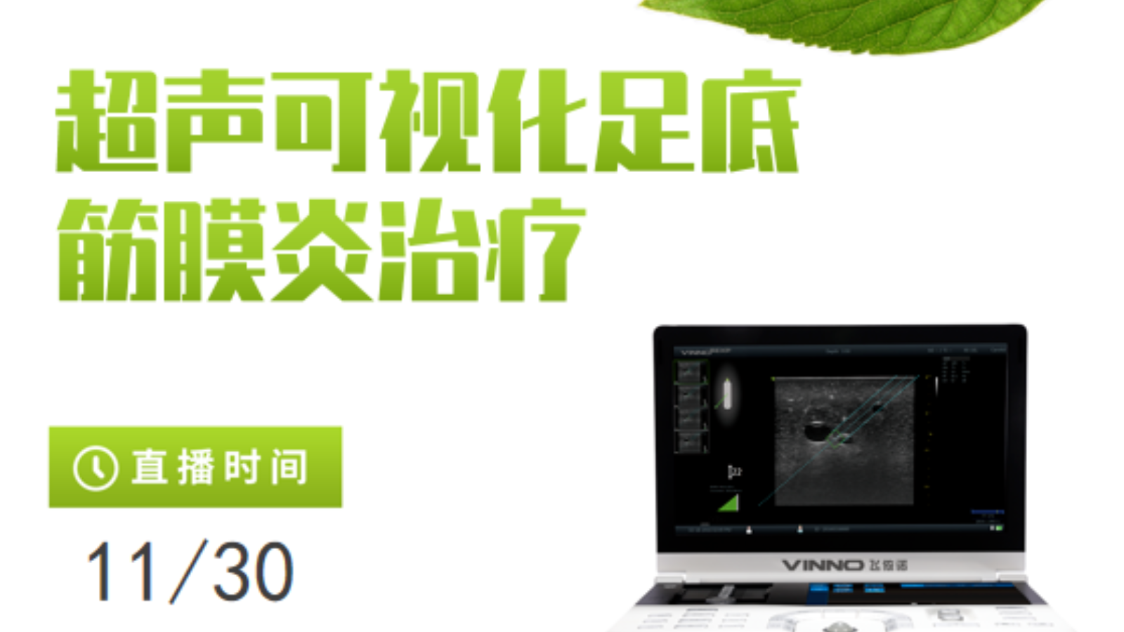 专家讲堂预告 | 超声可视化足底筋膜炎治疗