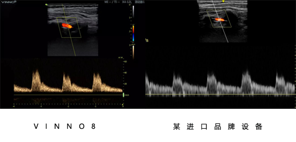 飞依诺彩超设备与其他品牌设备对比