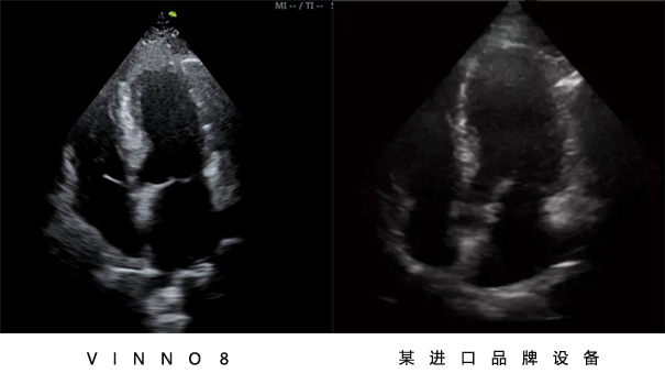 飞依诺彩超设备与其他品牌设备对比