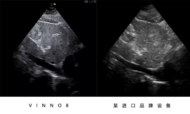 飞依诺彩超设备与其他品牌设备对比